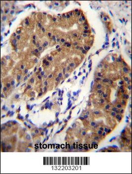 DCC Antibody (Center)