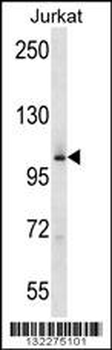 MAP4K2 Antibody (Center)