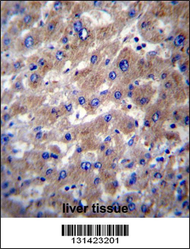 SLMO2 Antibody (Center)