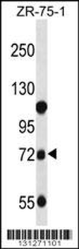 GUSB Antibody (C-term)