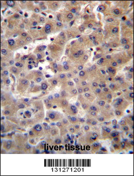 GUSB Antibody (C-term)