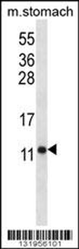 ATP5J Antibody (Center)