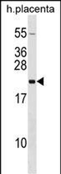 GH2 Antibody (N-term)
