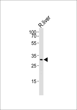 Rat-Cebpb-S105 Antibody