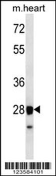 STX8 Antibody (N-term)