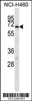 GABRA4 Antibody (Center)
