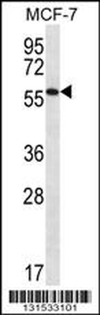 SAAL1 Antibody (C-term)
