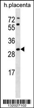 STARD4 Antibody (N-term)