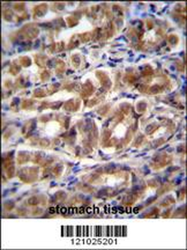 FABP2 Antibody (N-term)