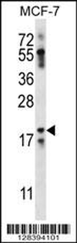 NRN1L Antibody (Center)
