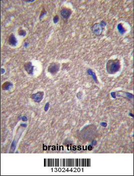 ANKS1B Antibody (Center)
