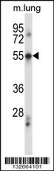 PDCD7 Antibody (C-term)