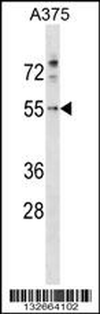 PDCD7 Antibody (C-term)