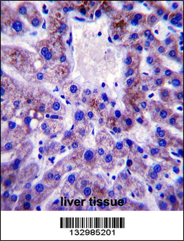 UBE2W Antibody (C-term)