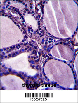 TRIM23 Antibody (N-term)