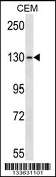 GRM1 Antibody (C-term)