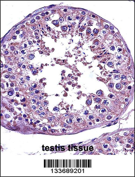STAT4 Antibody (C-term)