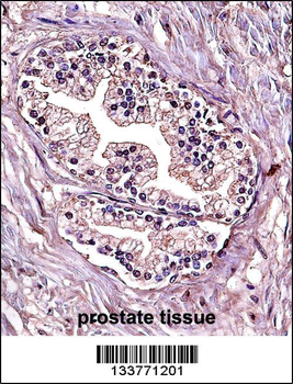 PPP4C Antibody (Center)