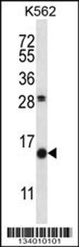 SCGB1D2 Antibody (Center)