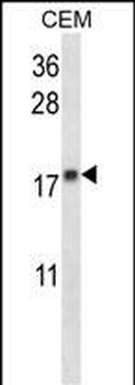 MGMT Antibody (N-term)