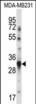 TNFSF13B Antibody (N-term)