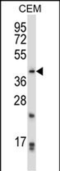PITX2 Antibody (N-term)