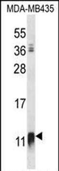NDUFAB1 Antibody (C-term)