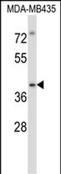 Mouse Irak4 Antibody (C-term)
