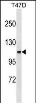 COL3A1 Antibody (C-term)