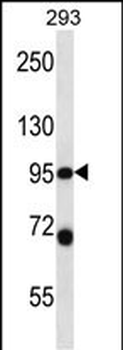 PSMD2 Antibody (N-term)