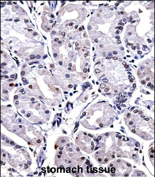 FOXP4 Antibody (C-term)