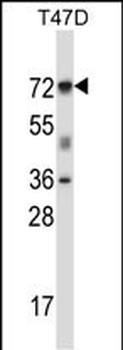 FOXK2 Antibody (N-term)