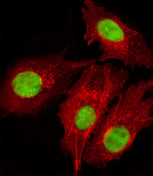 FOXD1 Antibody (N-term)