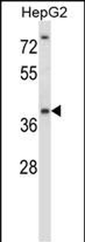NANOS1 Antibody (Center)