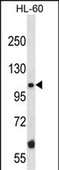Mouse Taok2 Antibody (Center)