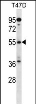ARFGAP3 Antibody (C-term)