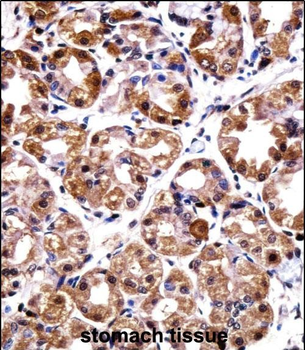 POLI Antibody (C-term)