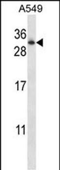 RAB11A Antibody (Center)