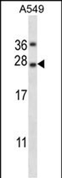 TNFSF14 Antibody (Center)