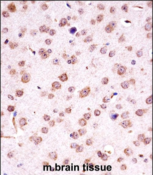 Mouse Chuk Antibody (C-term)