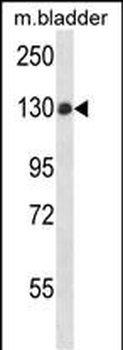 PTPN14 Antibody (C-term)