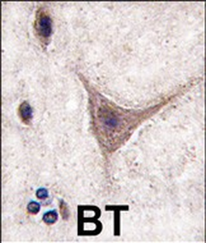 CDH10 Antibody (C-term)