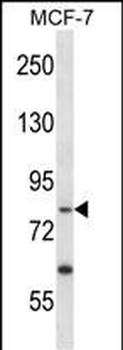PRKRIR Antibody (N-term)