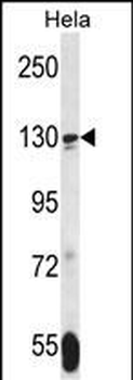 TNKS Antibody (N-term)