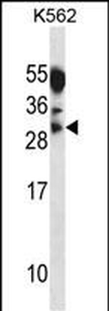 MYOG Antibody (Center)