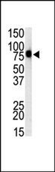 Mouse TLR1 Antibody (C-term)