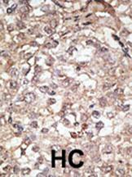 Mouse TLR1 Antibody (C-term)