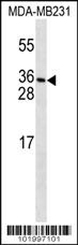PDGFC Antibody (N-term)