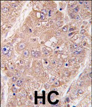 UVRAG Antibody (Center)