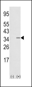SNAI1 Antibody (N-term D24)